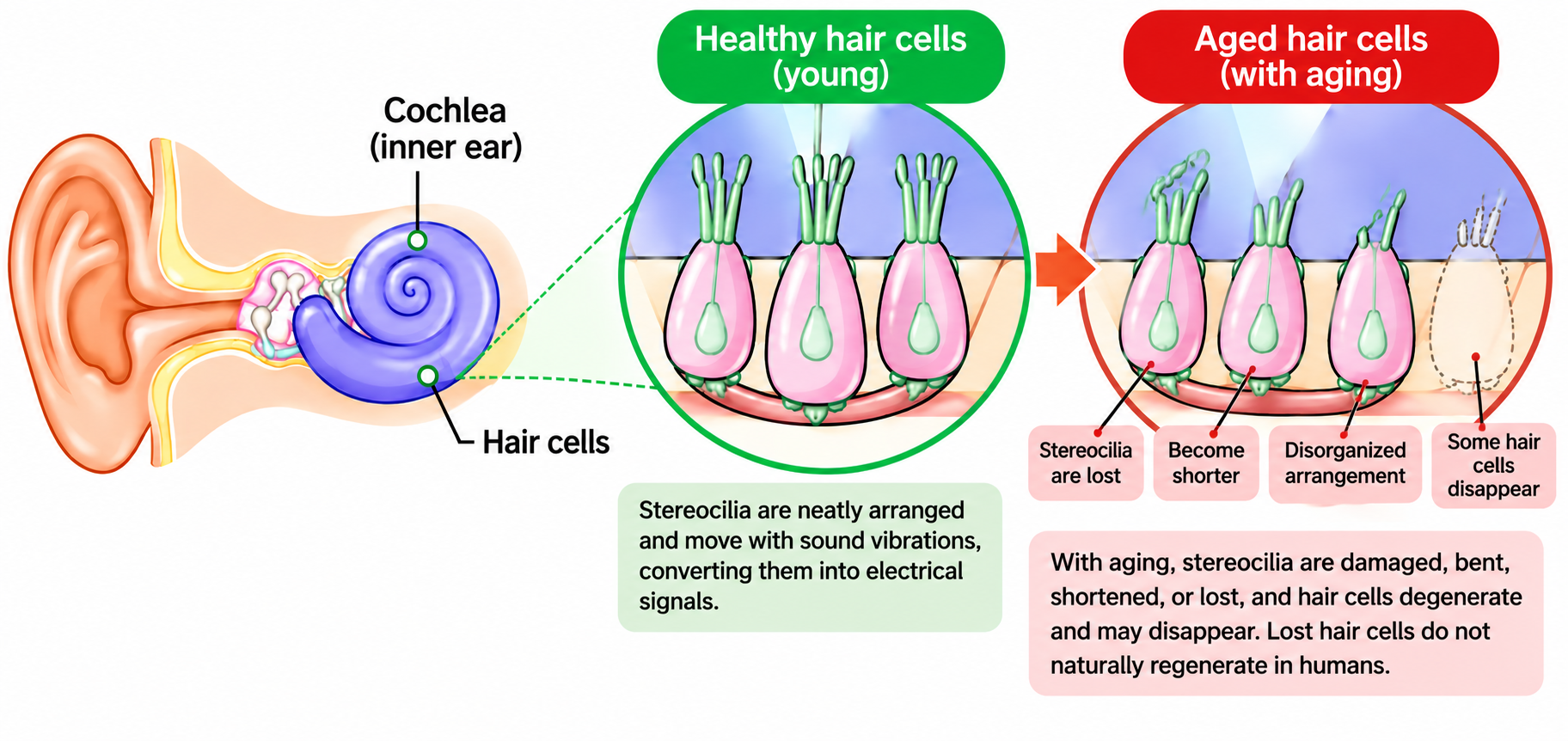 Ear Age System